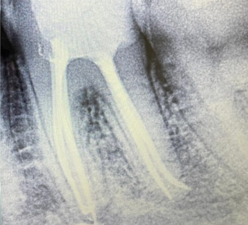 Endodontics